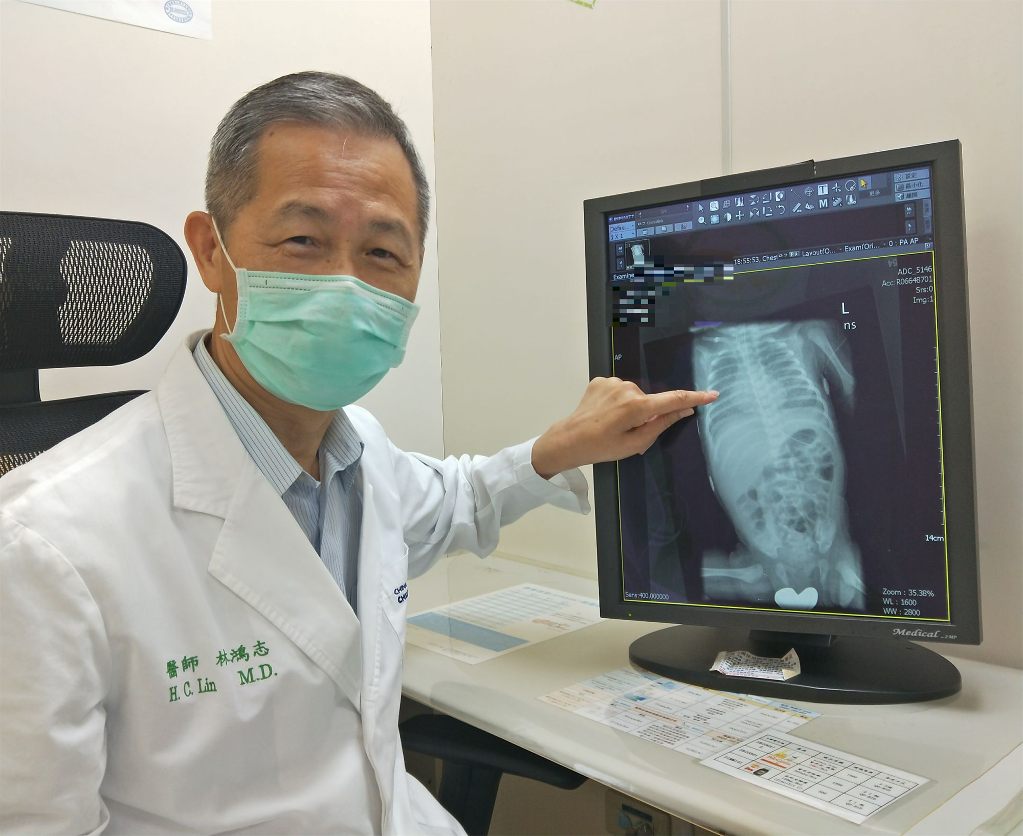 先天基因異常呼吸窘迫症三歲女童無法呼吸等換肺| 最新消息- 中國醫藥大學附設醫院