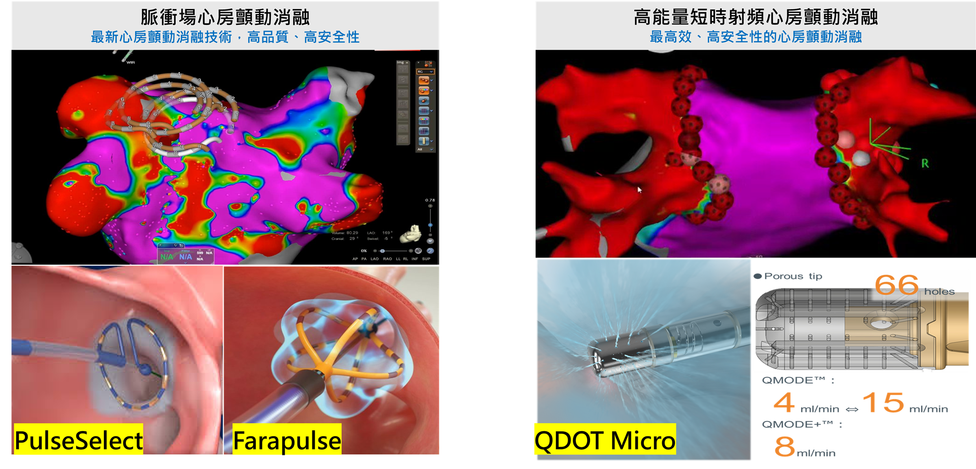 心臟血管系| 特色介紹- 中國醫藥大學附設醫院