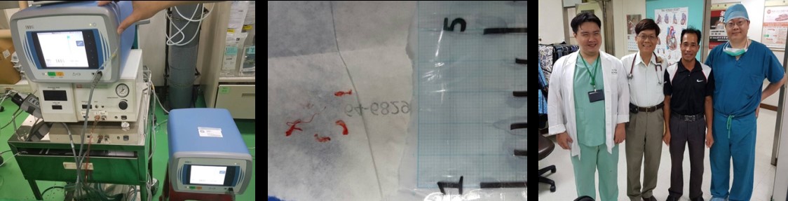 Using 2 EKOS machines (blood vessel ultrasound thrombolysis procedute) and ECMO to successfully treat a 12 year old lung embolism. The success was internationally known.