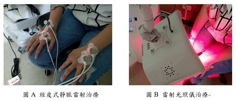 圖A 經皮式靜脈雷射治療