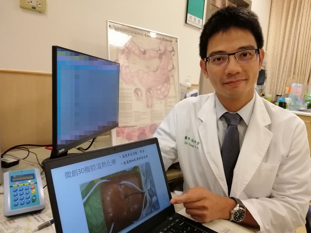 大腸直腸外科張伸吉醫師|大腸癌腹膜轉移 微創3D手術加腹腔溫熱化療 大腸直腸外科張伸吉醫師|大腸癌腹膜轉移 微創3D手術加腹腔溫熱化療