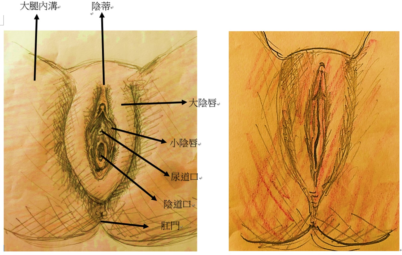 整形外科 廖力穎醫師|私密處肥厚運動卡卡易破皮 就醫解決「妹妹」困擾恢復自信心 整形外科 廖力穎醫師|私密處肥厚運動卡卡易破皮 就醫解決「妹妹」困擾恢復自信心