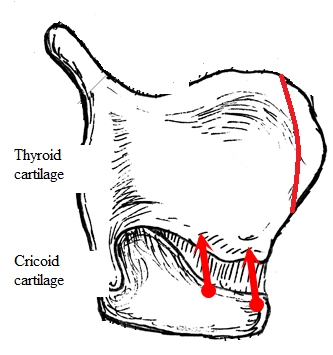如圖所示，沿頸部皺褶分出甲狀軟骨