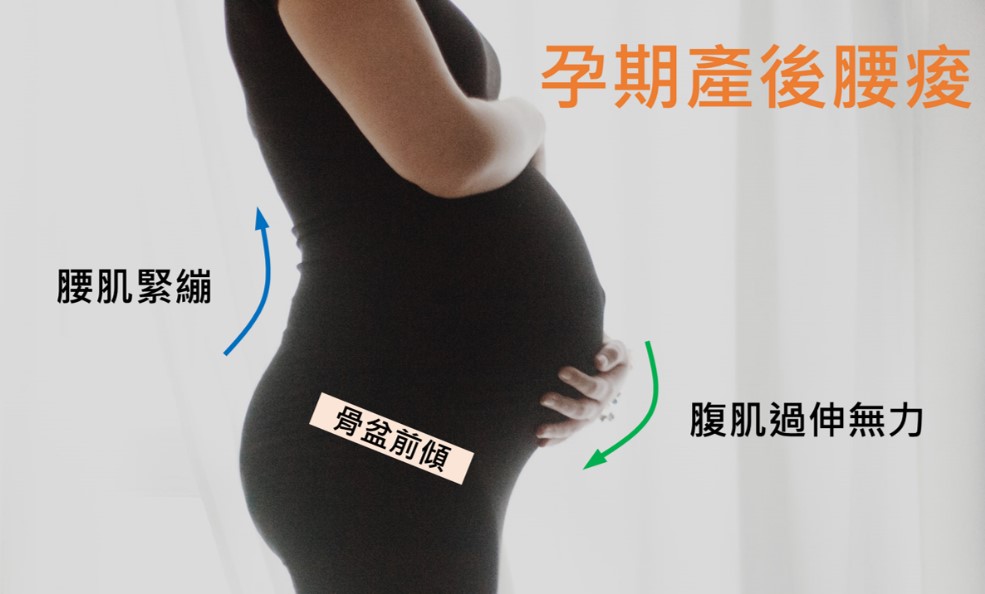孕期產後腰痠