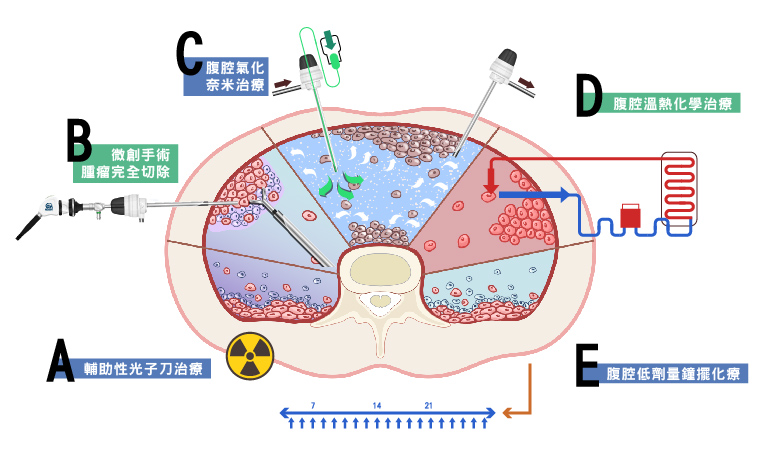 腹膜腫瘤整合性治療