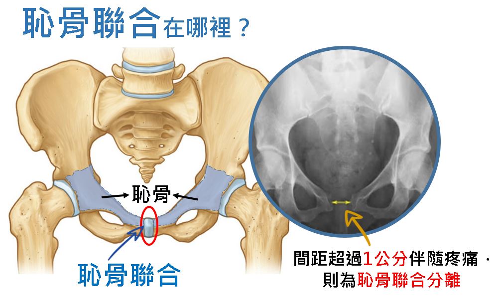 恥骨聯合位置