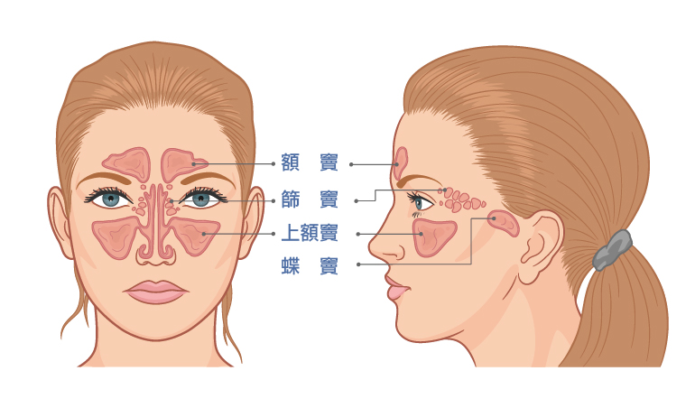 戴志展醫師|鼻竇炎跟鼻炎是不同的位置在發炎