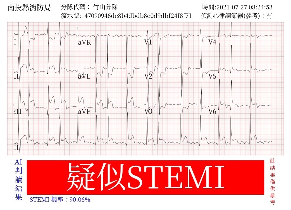 「中台灣AI救心網」急性心肌梗塞到院前遠距診斷系統