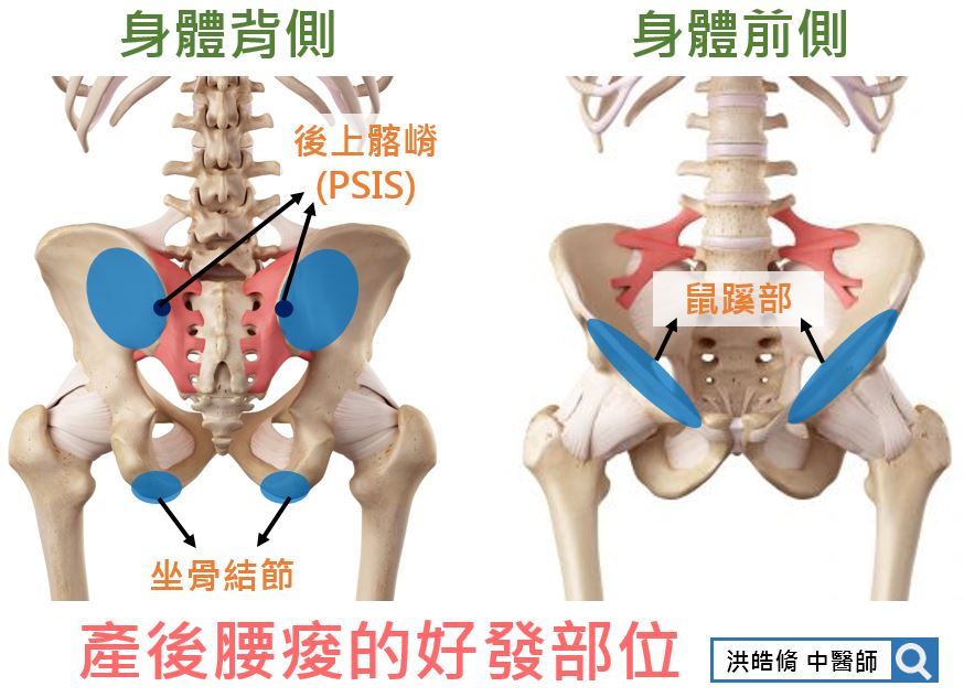 產後腰痠的好發部位