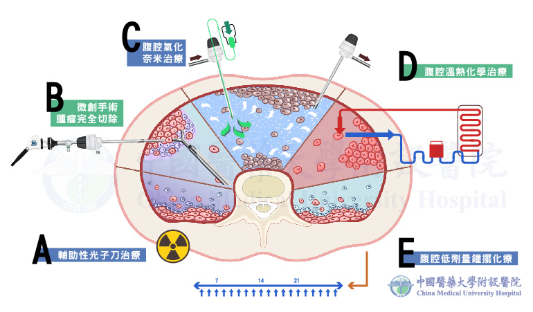 腹膜腫瘤整合性治療