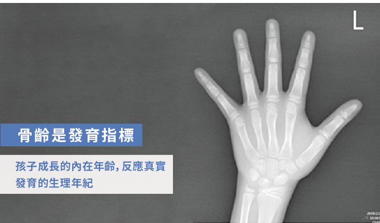 蔡輔仁醫師|骨齡是發育指標，孩子成長的內在年齡，反應 真實發育的生理年紀