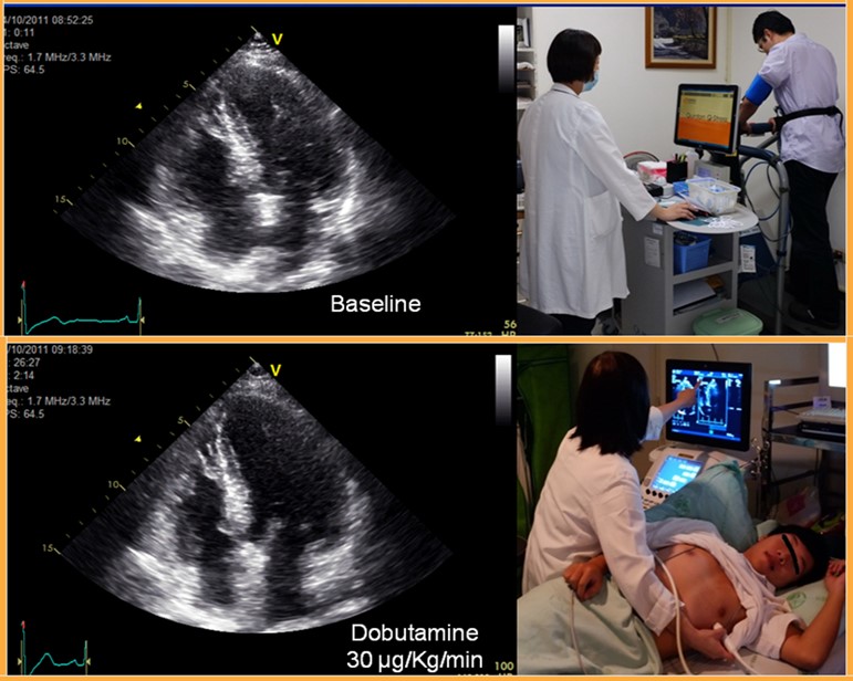 Since 2011, the hospital started providing loaded echocardiography examinations, with an annual increase of number of patients. Currently, the hospital sees around 1,000 cases each year, the highest in Taiwan
