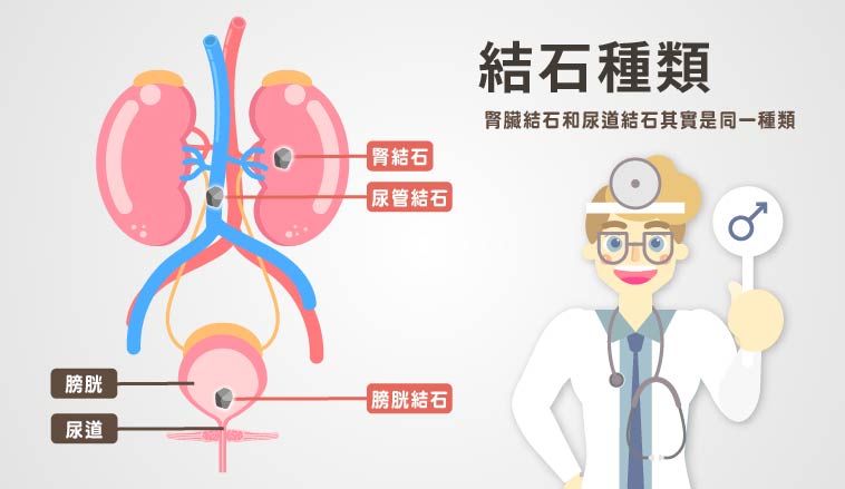 邱鴻傑醫師 | 腎臟結石和尿道結石其實是同一種類