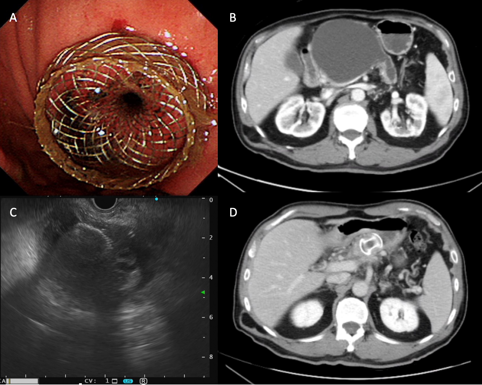 消化系| 特色介紹- 中國醫藥大學附設醫院