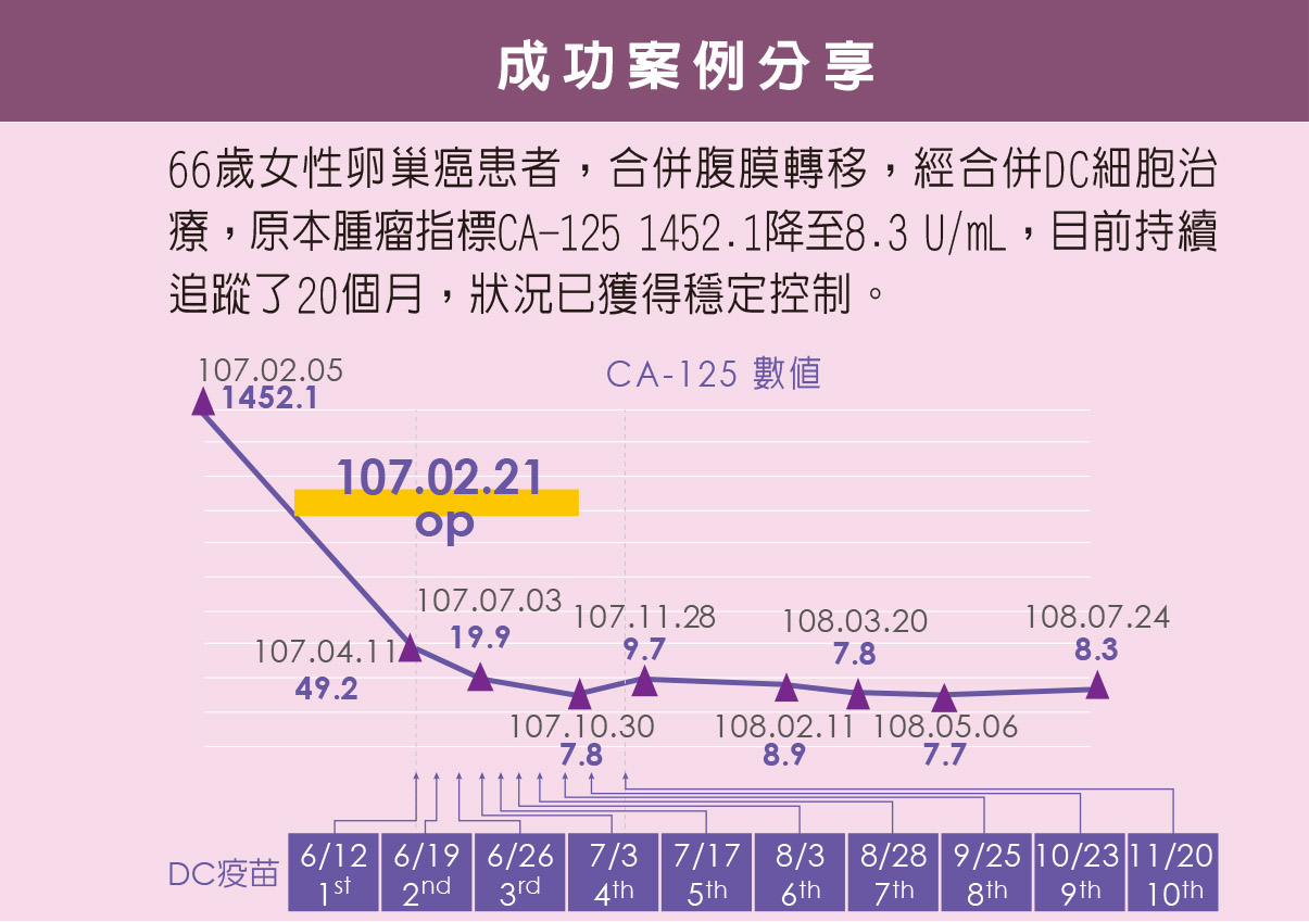 DC細胞治療上皮性卵巢癌成功案例