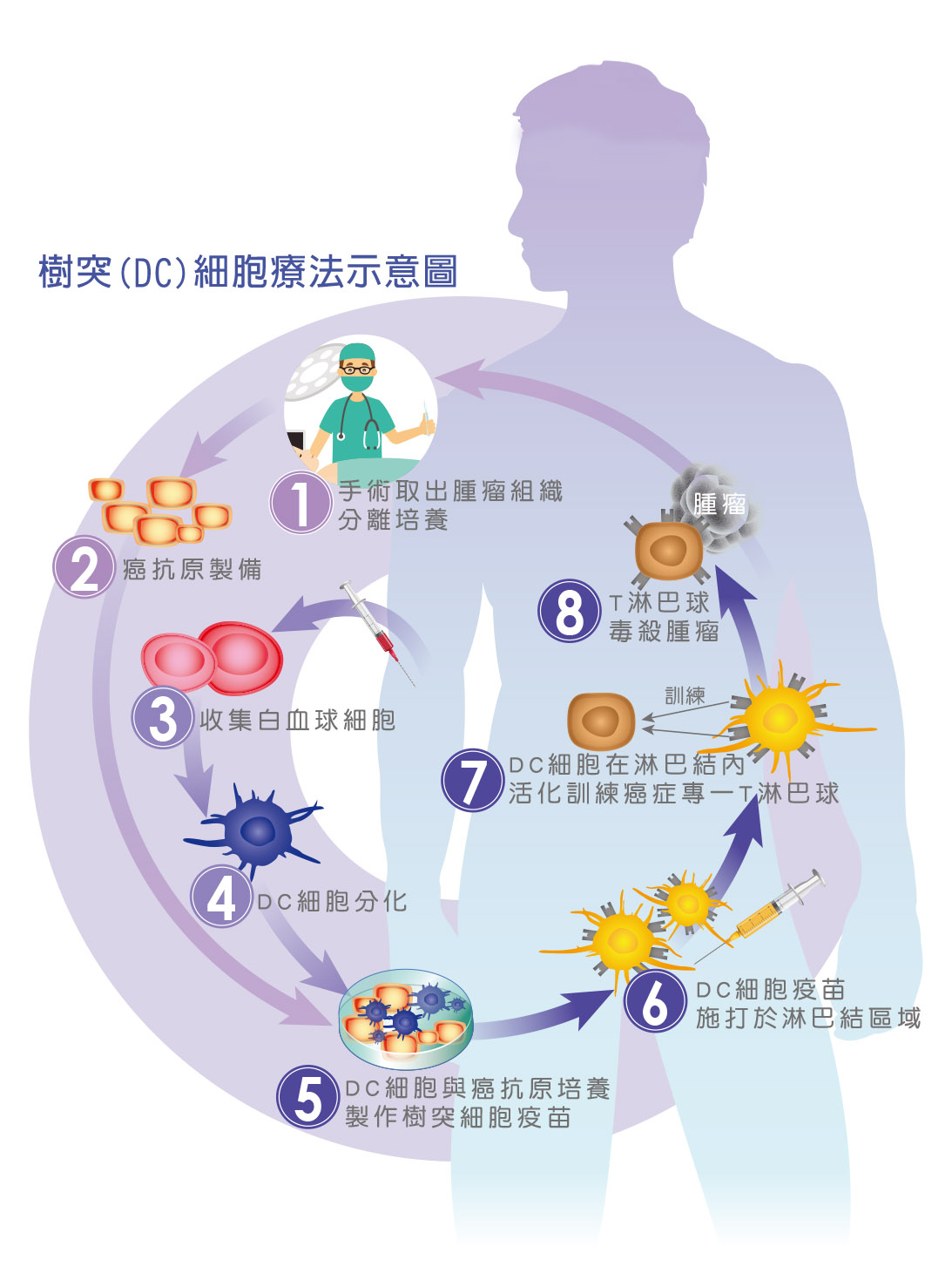 樹突(DC)細胞療法示意圖