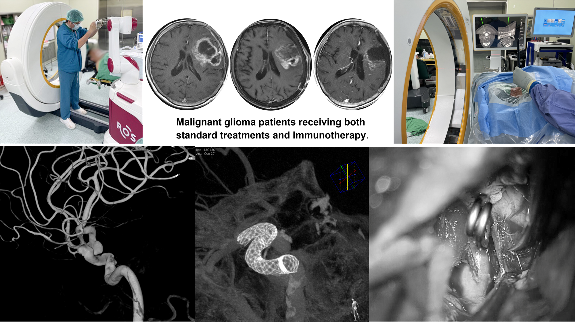 Neurosurgery | Our Speciality - China Medical University Hospitalno 1img