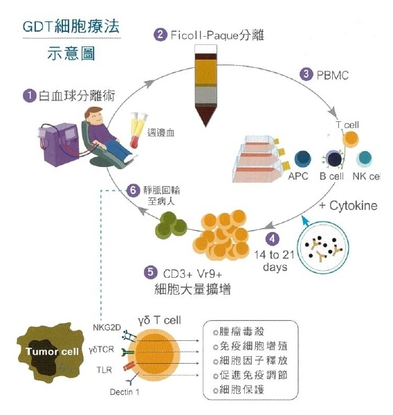 GDT細胞療法示意圖