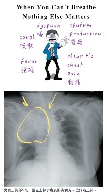 吳女士胸部X光，圖左上標示處為肺炎病兆，位於右上肺。