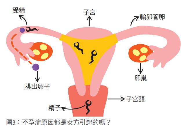 圖3：不孕症原因都是女方引起的嗎？
