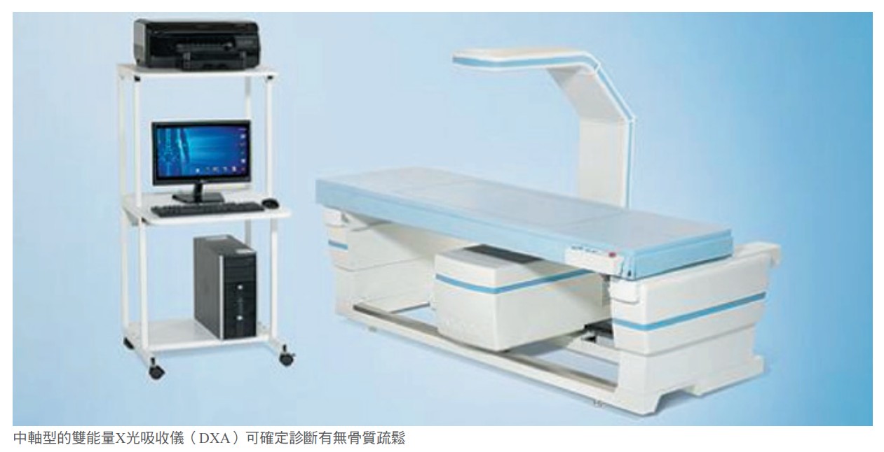 中軸型的雙能量X光吸收儀（DXA）可確定診斷有無骨質疏鬆