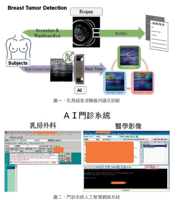 圖一、乳房超音波腫瘤判讀及診斷