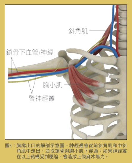 圖3：胸廓出口的解剖示意圖。