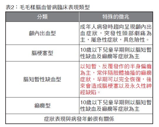 表2：毛毛樣腦血管病臨床表現類型