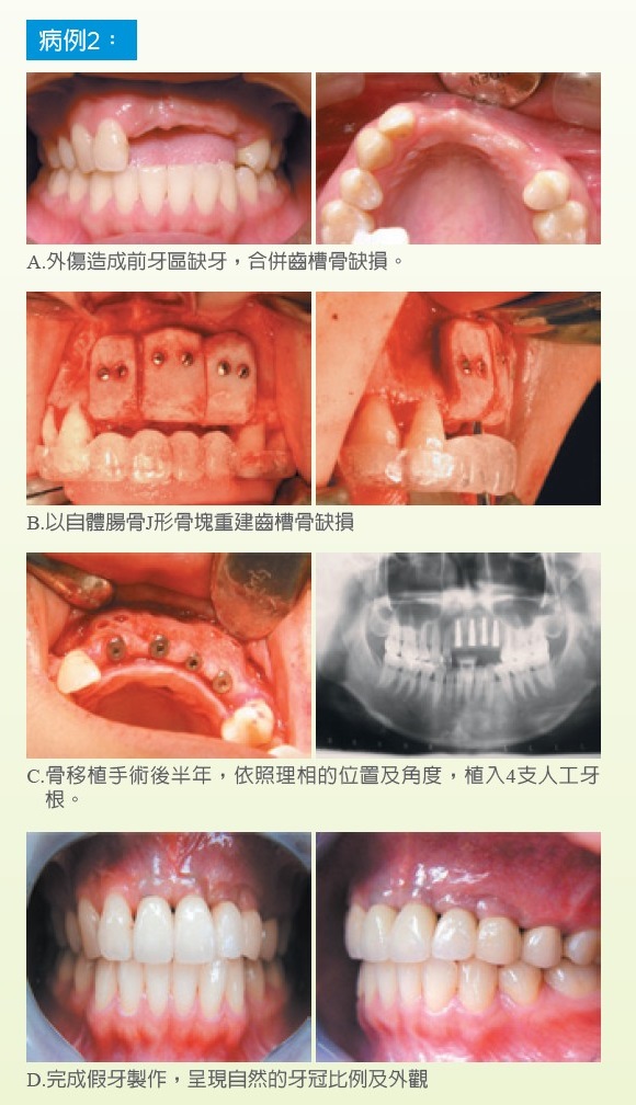 病例2