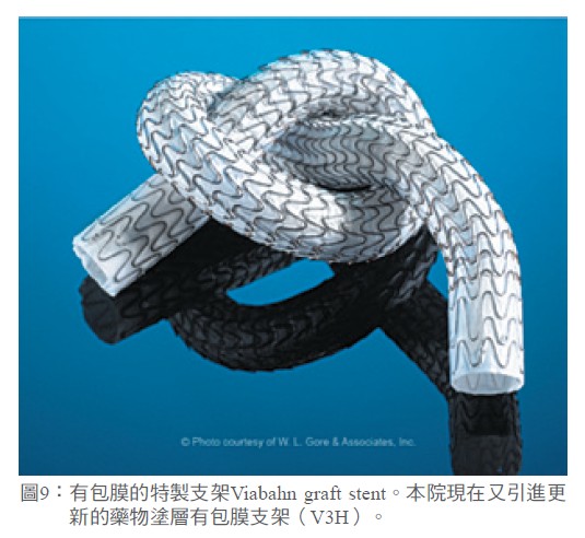 圖9： 有包膜的特製支架Viabahn graft stent。本院現在又引進更新的藥物塗層有包膜支架（V3H）。