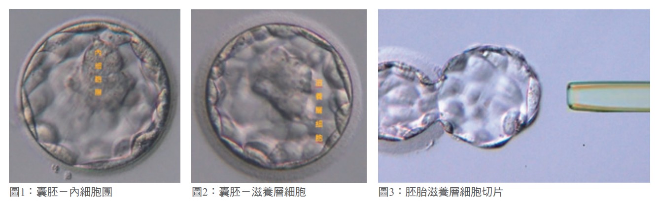 圖1：囊胚－內細胞團