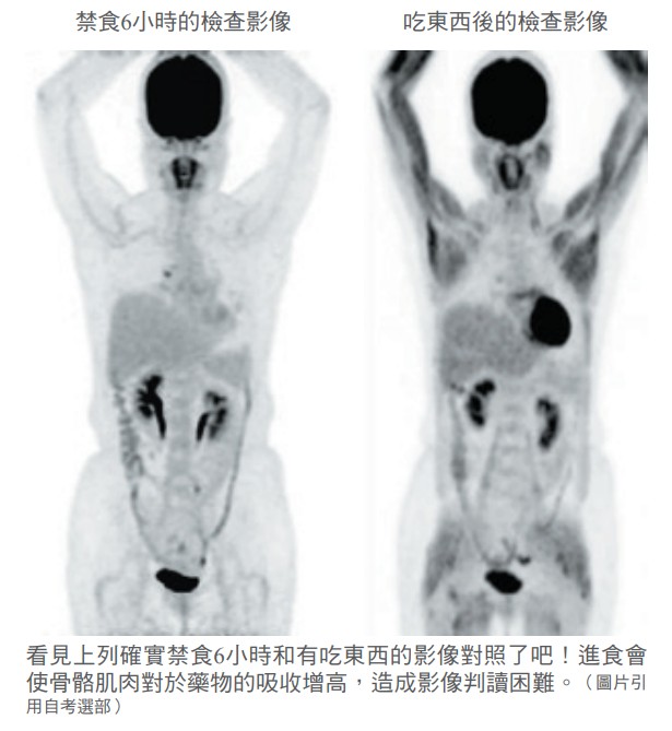 禁食6小時的檢查影像