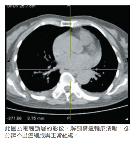 此圖為電腦斷層的影像