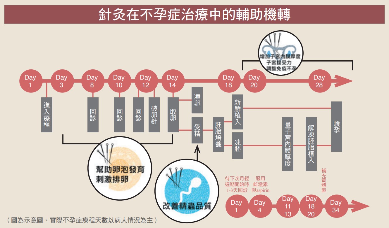 針灸在不孕症治療中的輔助機轉