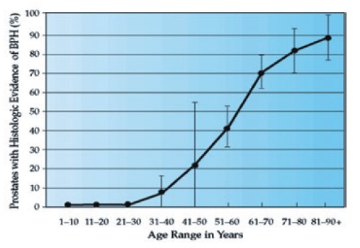 男性攝護腺肥大的發生率，會隨著年齡像爬樓梯一樣節節升高。