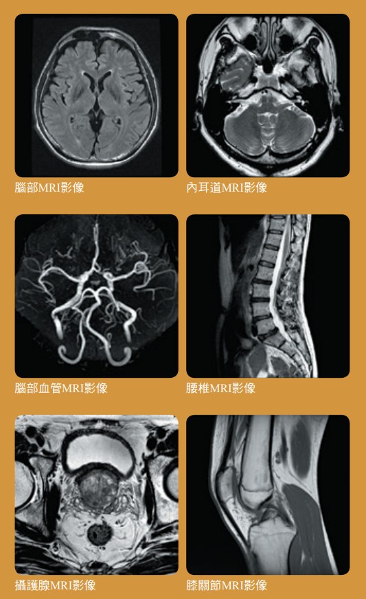 MRI影像