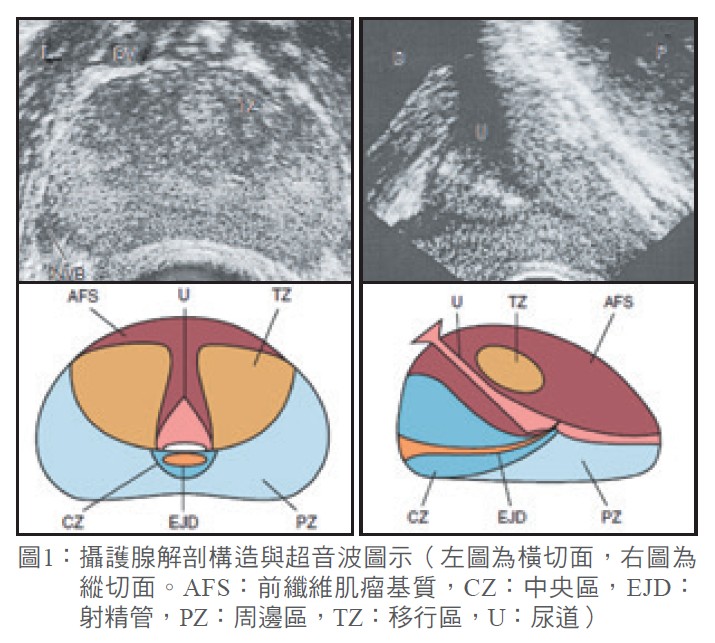 圖1： 攝護腺解剖構造與超音波圖示