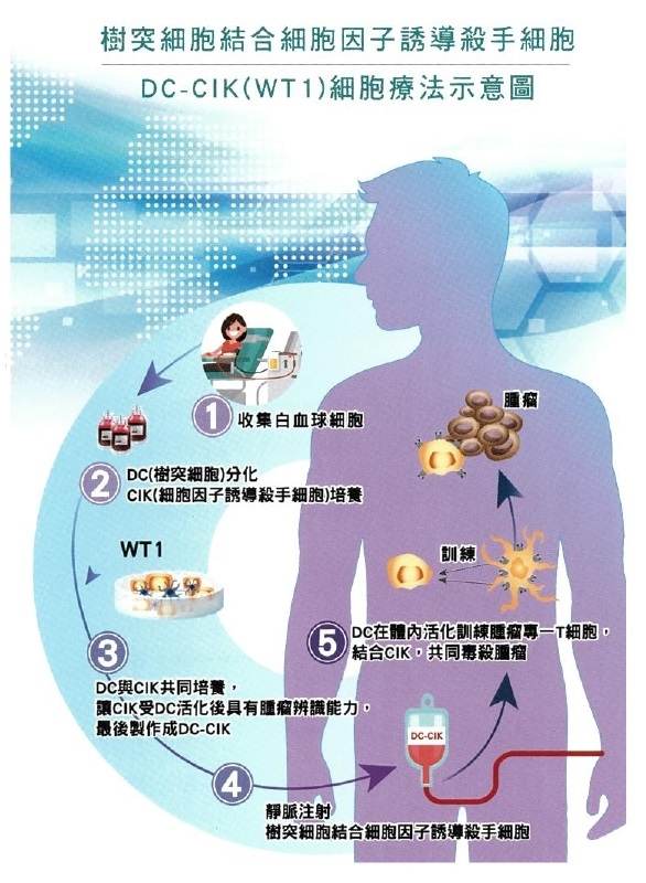DC-CIK(WT1)細胞療法示意圖