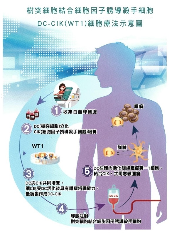 DC-CIK(WT1)細胞療法示意圖