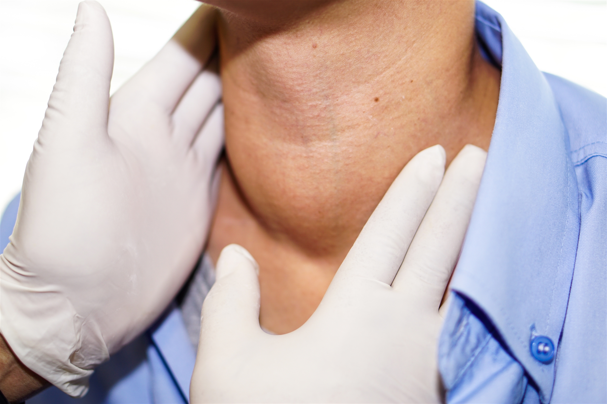 Neck mass 頸部腫瘤須知 | 衛教單張 - China Medical University