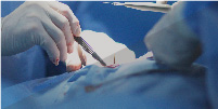 Surgery