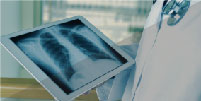 Thoracic Surgery