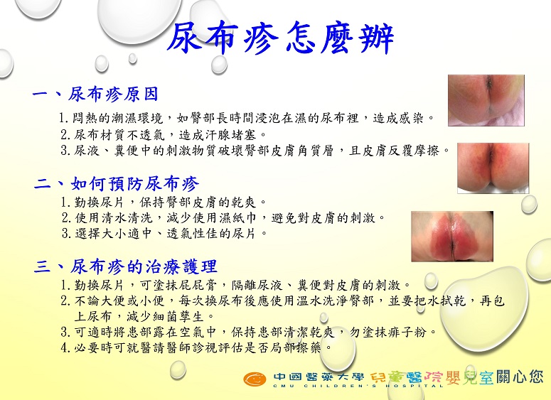 尿布疹怎麼辦 衛教海報 中國醫藥大學附設醫院 尿布疹怎麼辦 衛教海報 中國醫藥大學附設醫院
