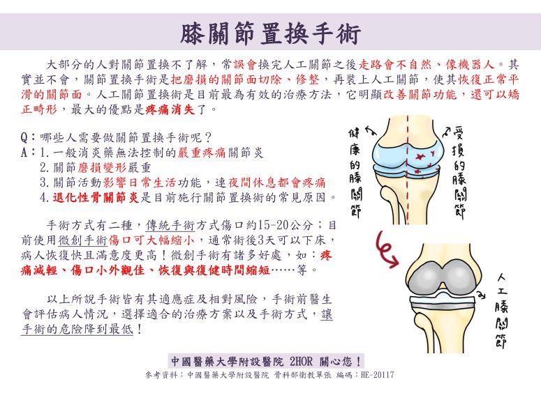 關節置換手術/H-OR | 衛教海報 - 中國醫藥大學附設醫院 第 1張圖片