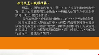 再一次心動-心臟節律器