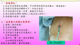 經皮腎臟造口術(簡稱：腎造瘻管)返家注意事項