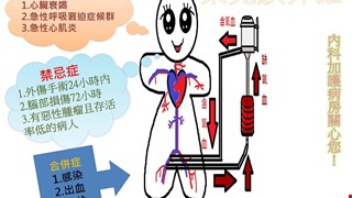 葉克膜介紹