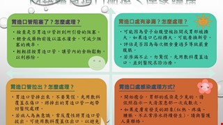 內視鏡胃造口術後之居家護理