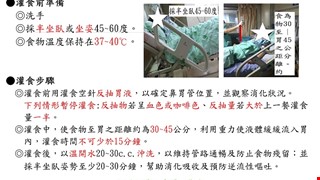 鼻胃管灌食
