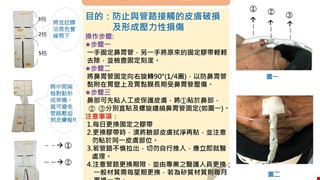 鼻胃管固定法